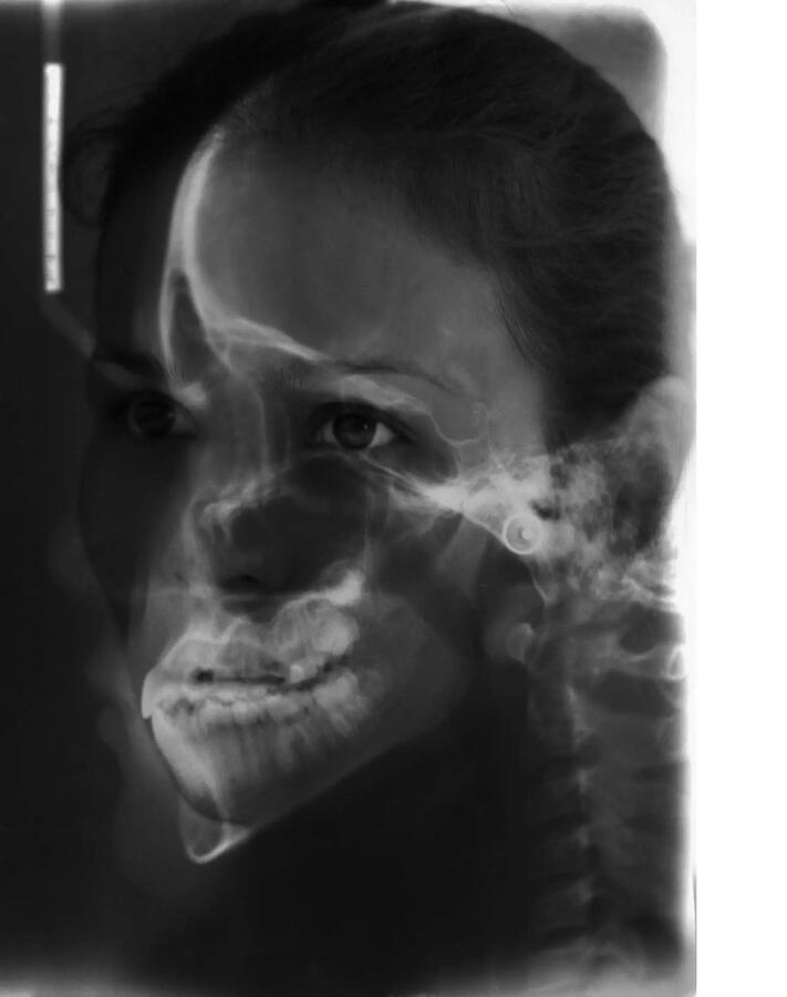 Iza Calzado, Skull, Manila